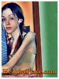 Dalam foto melukai diri ini, seorang gadis dengan anoreksia juga terlibat dalam melukai diri sendiri dengan membenturkan dan memar bagian tubuhnya