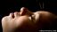 Penggunaan dan Efektivitas Akupunktur